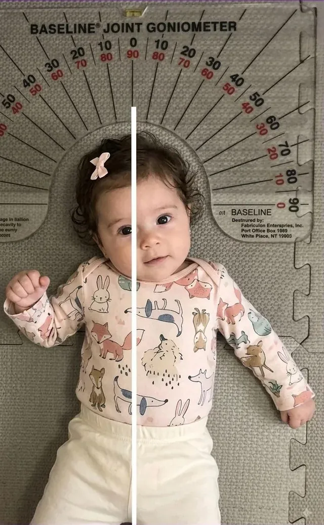foto de uma criança recebendo avaliação de fisioterapeuta infantil